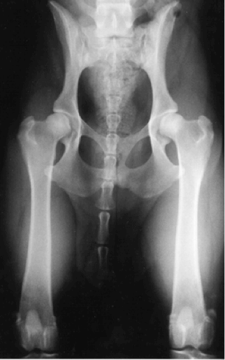 doyalson pennhip pelvic x-ray